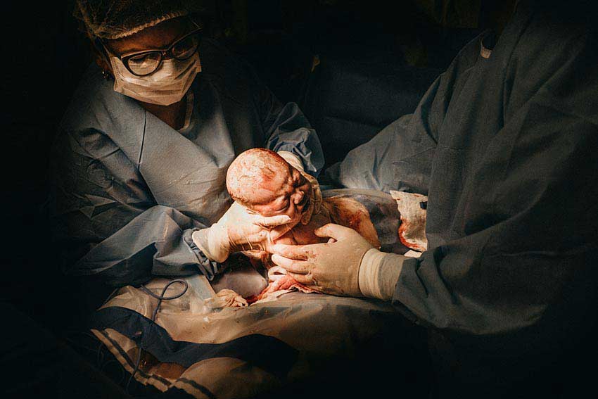c section experience What hurts more cesarean or normal delivery